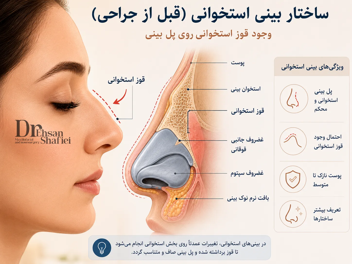 جراحی بینی استخوانی؛ همه‌چیزی که قبل از تصمیم باید بدانید