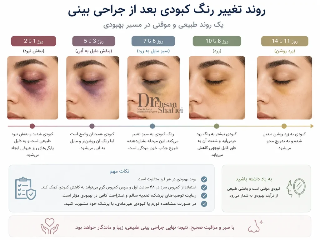 مراحل تغییر رنگ کبودی بعد از عمل بینی استخوانی طی دو هفته