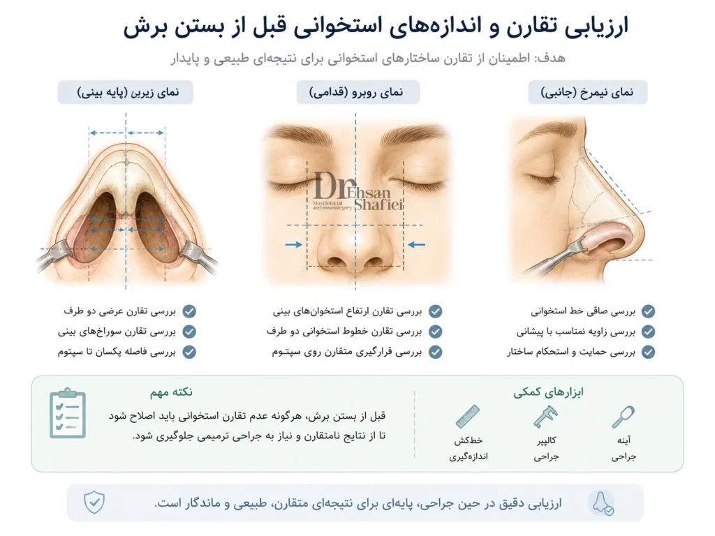 ارزیابی تقارن استخوان بینی پیش از پایان جراحی